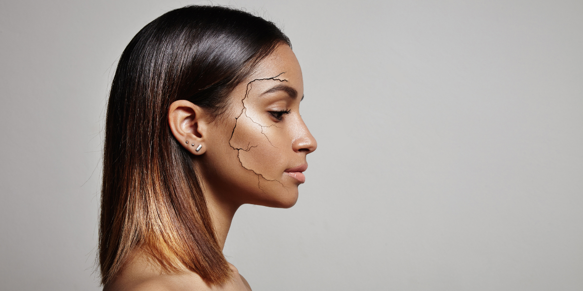 Alopécie cicatricielle : comprendre cette perte de cheveux irréversible